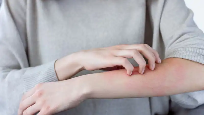 Cilt Kanserinin Belirtilerini Gözden Kaçırmayın: Dermatolog Uyardı!