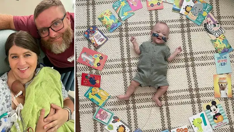 Hayatin Sınırları: Dünyanın En Prematüre Bebeği 280 Gram Olarak Doğdu
