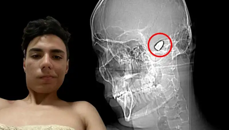 Patlamaya Hazır Bomba Abdülkadir’in Kafasında: Gerçek Bir Hayatta Kalma Hikayesi
