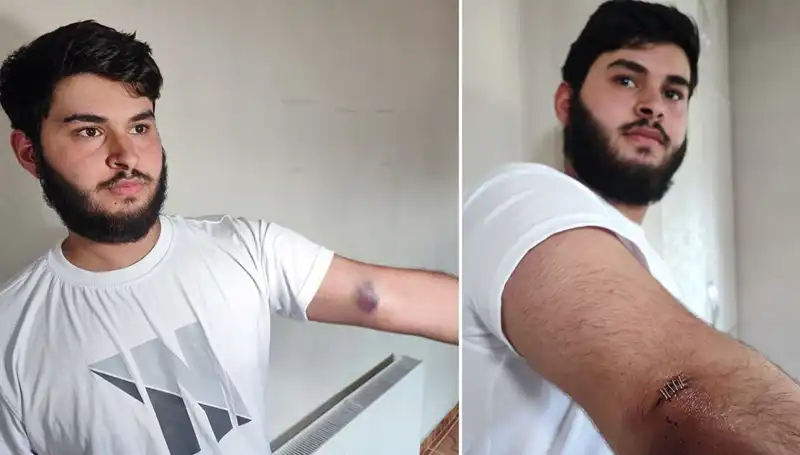 Bahçeye Kaçan Top, Mahallede Renklere Yol Açtı: Conolar ve Kamyonet Sırada!